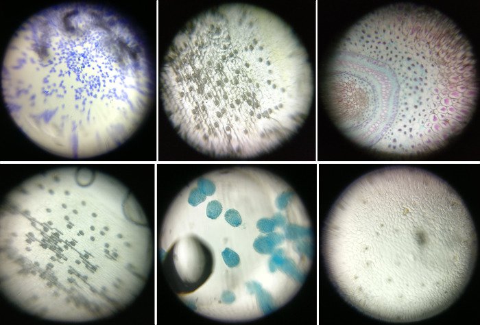 Plusieurs préparations microscopiques observées avec un Foldscope et photographiées à l'aide d'un smartphone. De gauche à droite et de haut en bas: cellules humaines, épiderme de plante, rhizome de fougère (lame commerciale), épiderme de plante, larves d'aptaisia (anémone de mer) et épiderme de plante).